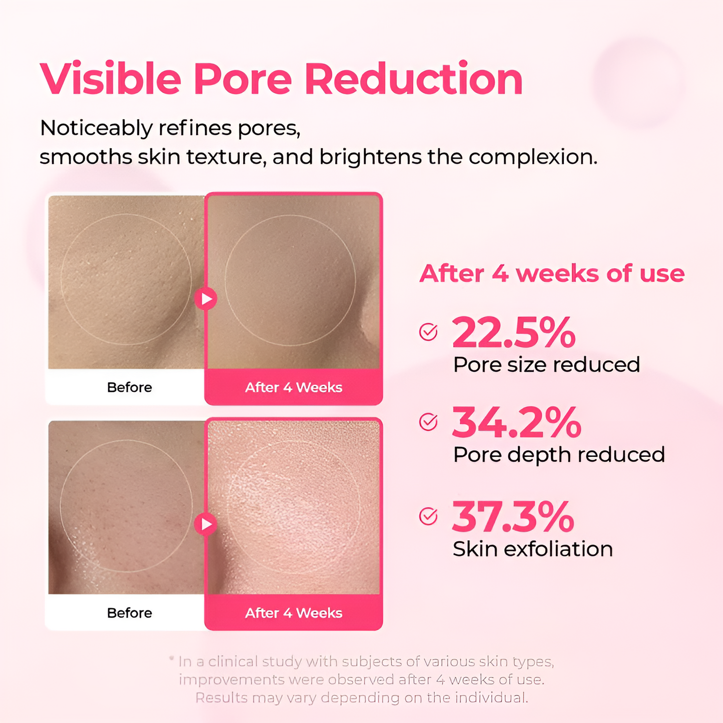 Pink Spicule Serum - For Radiant Skin & Refined Pores